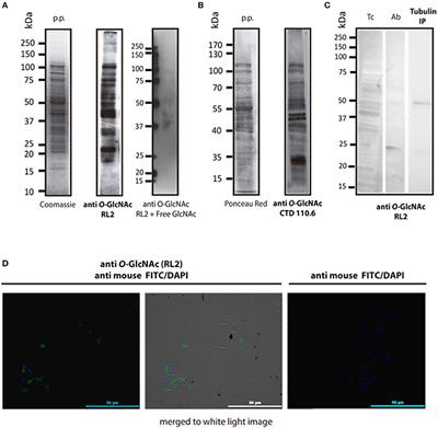 Identification of O-Glcnacylated Proteins in Trypanosoma cruzi